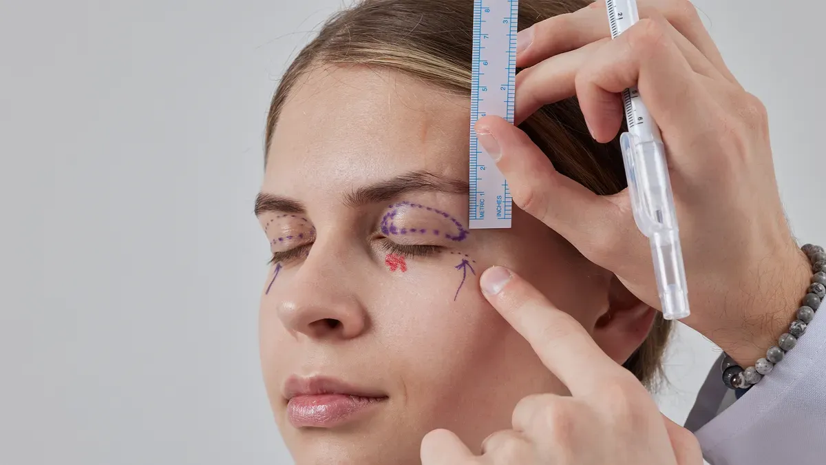 Blefaroplastia