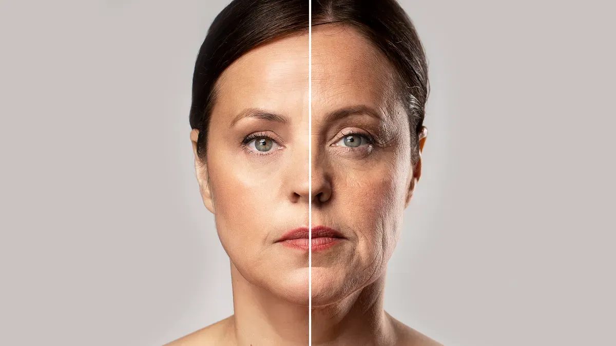 Lifting Facial Deep Plane