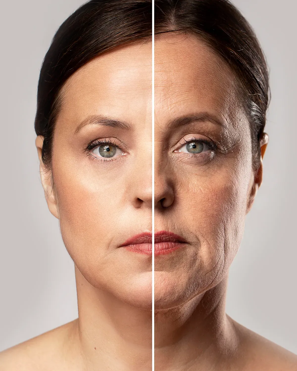 Lifting Facial Deep Plane